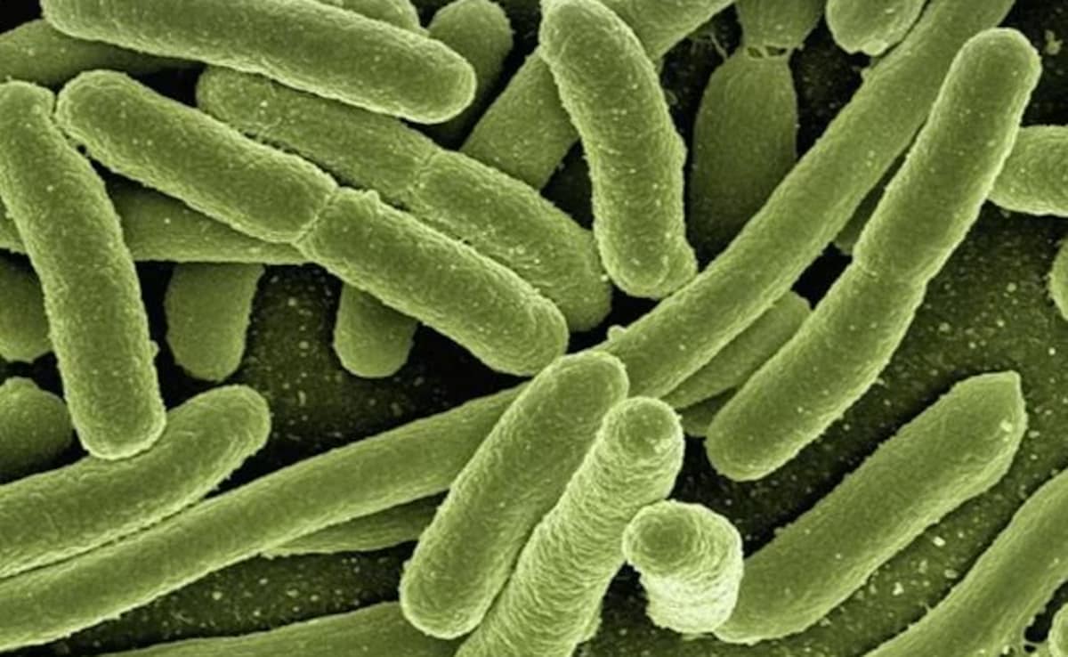 Tanzania Confirms New Outbreak Of Marburg Virus