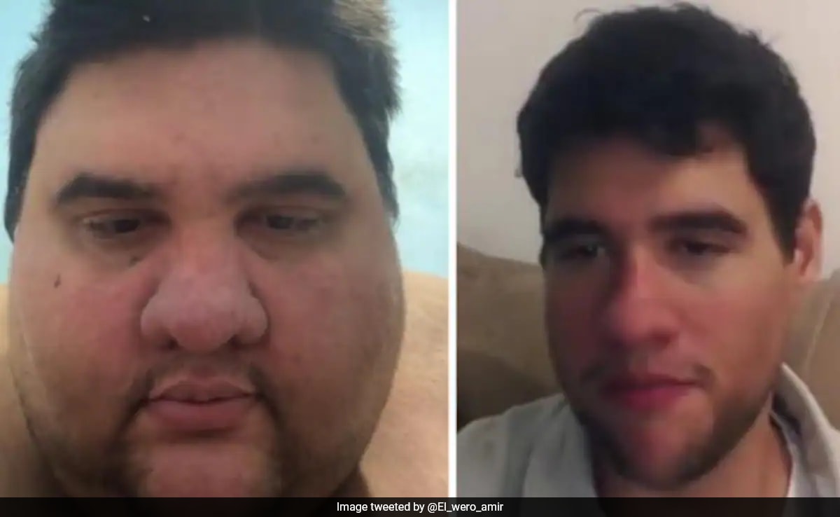 Brazilian Fitness Influencer Gabriel Freitas Known For 174-kg Weight Loss Dies At 37