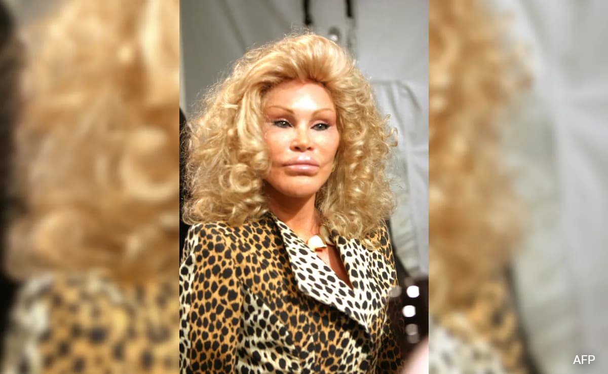 'Catwoman' Jocelyne Wildenstein, Cosmetic Surgery Aficionado, Dies At 79