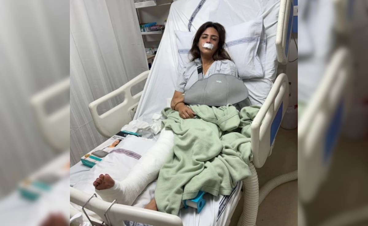 Salman Khan's Rakhi Sister Shweta Rohira Shares Pics After Major Accident: "Fractured Bones, Bruises And..."