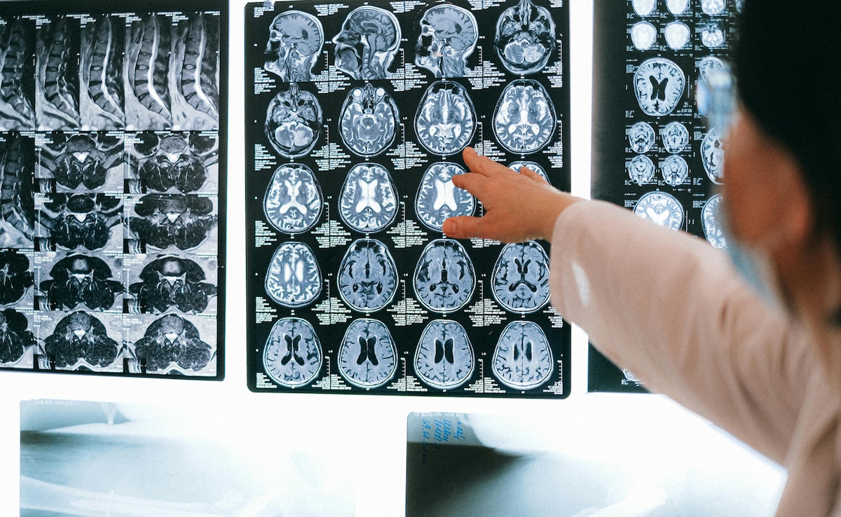 What Happens To Human Brain Just Before We Die? Scientists May Have The Answer