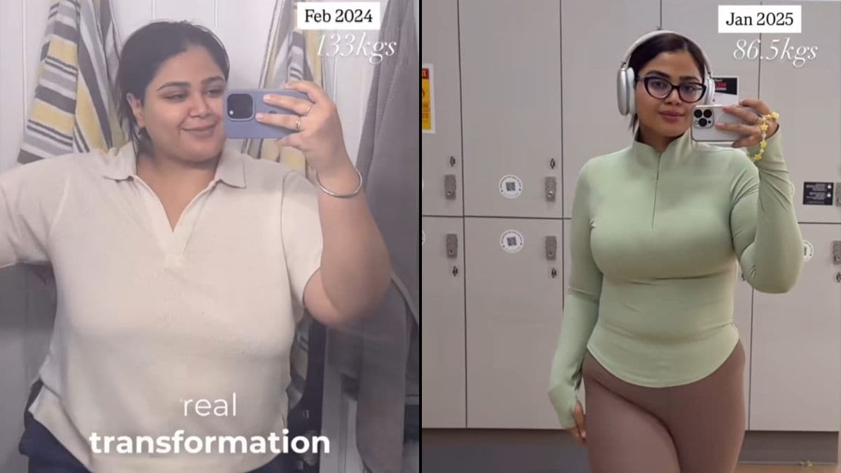 Beauty Influencer Sheds Over 40 Kg After Suffering Hair Loss, Shares How