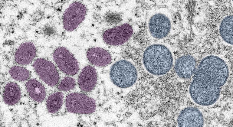 New recombinant mpox strain detected in UK and India, WHO urges continued monitoring